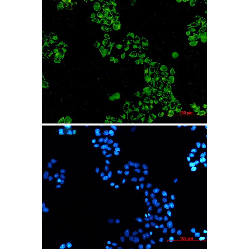 IF - GC1q R Rabbit mAb AP76509